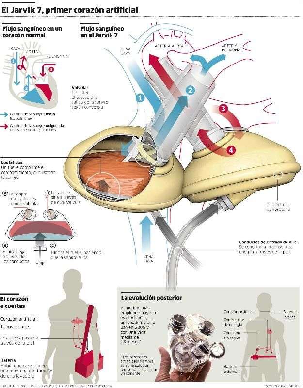 最新人体器官复制器｜人体器官再生技术前沿